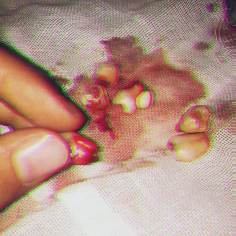 Numb